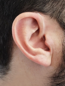 smart-ear-hearing-aid-akoustiko-barikoias-EAR